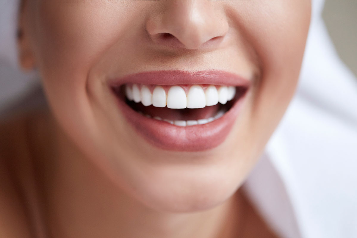 close up of a bright smile