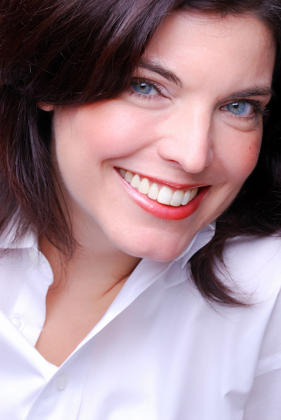 Full Smile Makeover Example Full Smile Makeover Example