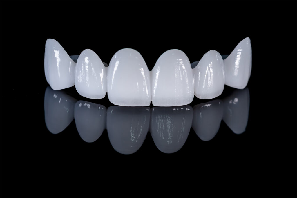 Same Day Tooth Replacement Option Same Day Tooth Replacement Option